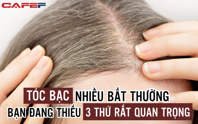 Tóc bạc nhiều đến bất thường, đừng nghĩ mình đang già đi, rất có thể bạn thiếu hụt 3 loại dinh dưỡng quan trọng