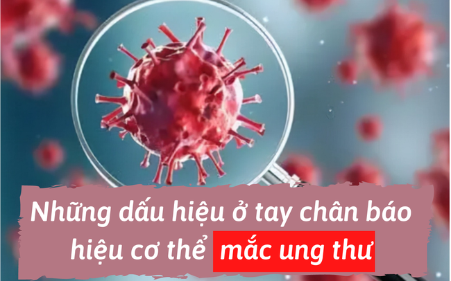 Tay chân chính là ‘ngọn cờ đầu’ báo hiệu cơ thể có tế bào ung thư: Chỉ cần tứ chi có một trong những dấu hiệu sau, cũng phải đi khám ngay!